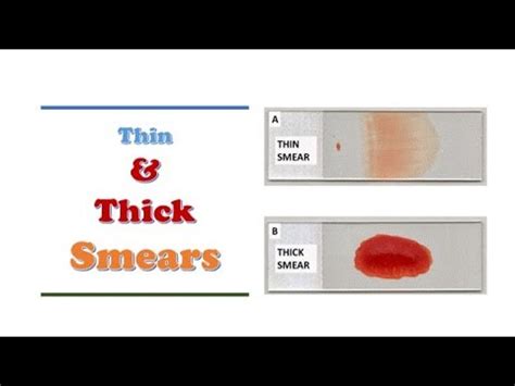 measure thickness of blood|why is my blood gooey.